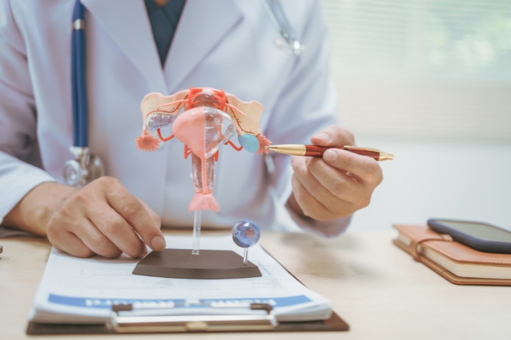 Ovarian Cancer