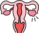 Polycystic Ovary Syndrome (PCOS) (4)