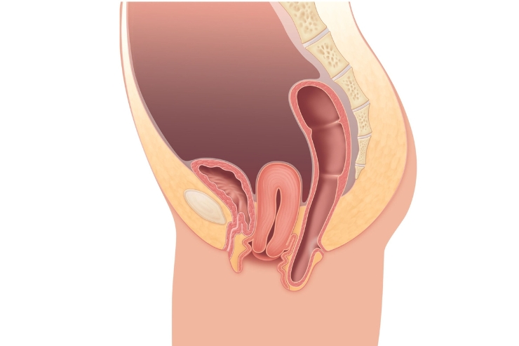 pelvic organ prolapse